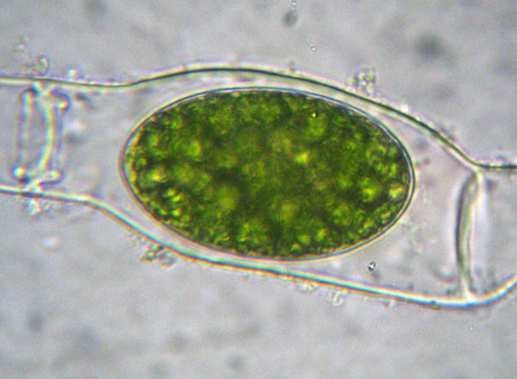 Alghe 3: Spirogyra sp